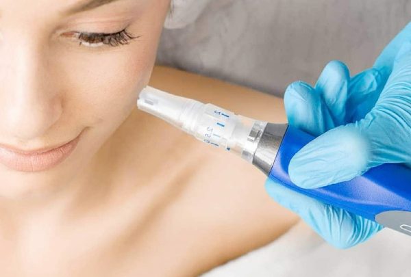 benefits-of-micro-needling